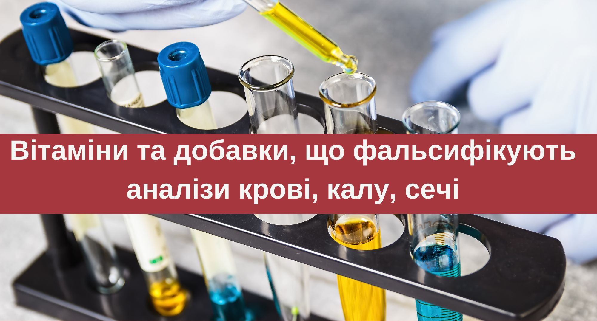 Вітаміни і дієтичні добавки, прийом яких слід припинити перед лабораторними аналізами
